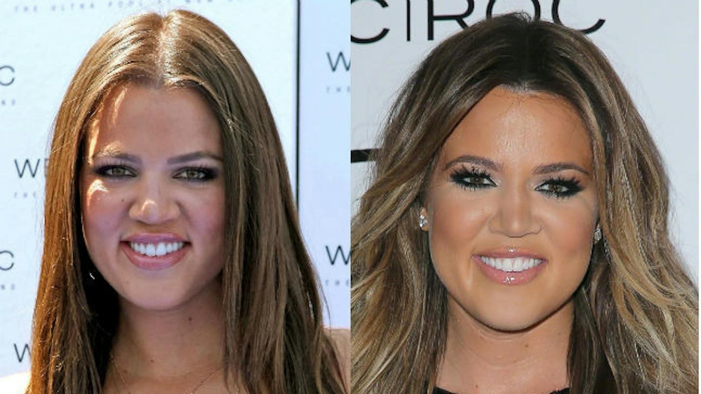 The Kardashian Jenners Before And After Rumoured Surgery See Their The Kardashian Jenners Before And After Rumoured Surgery See Their